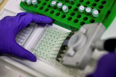 A scientist prepares protein samples for analysis in a lab at the Institute of Cancer Research in Sutton, Britain.