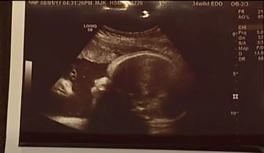 (Photo: A Pa. couple sees Jesus in their sonogram in a video posted by Fox 43 on August 22, 2017.)