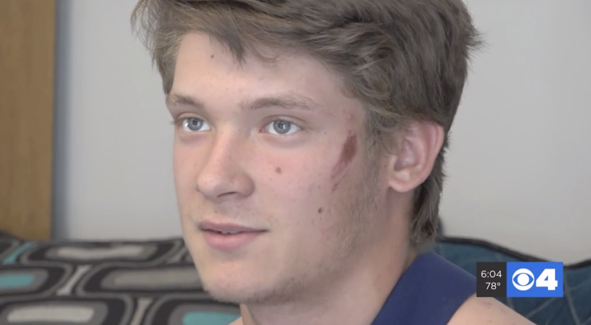 Teen Ben Foster survives fall down bluff, June 9, 2019