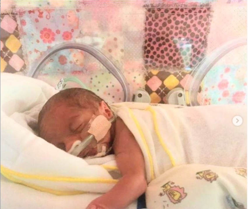 Baby Victoria Lee born weighing 2 pounds 5 ounces. Photo taken on Aug. 18, 2019.