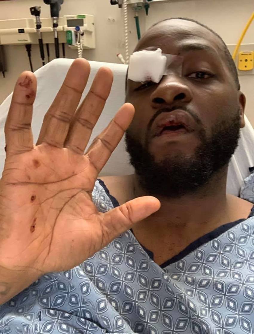 Demarco “Gemstones” Castle at a hospital after surviving an ambush in 2019. 