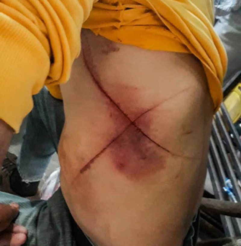 Venezuelan Christians forced to eat pages of the Bible, have 'crosses' etched into their bodies