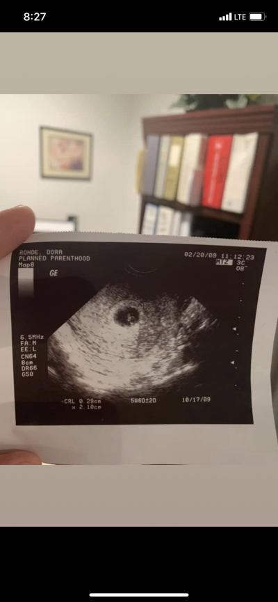 Dora Esparza's sonogram from Planned Parenthood.