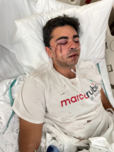 A Republican canvasser identified as Christopher Monzon lays in a hospital bed after he was attacked while handing out fliers on behalf of the Republican ticket in Hialeah, Florida, on Oct. 23.