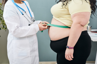 Obesity, unhealthy weight. Nutritionist inspecting a woman's waist using a meter tape to prescribe a weight loss diet.