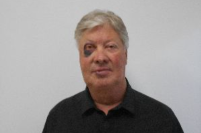 Gateway Church founder Robert Morris displays facial injuries from a recent fall.