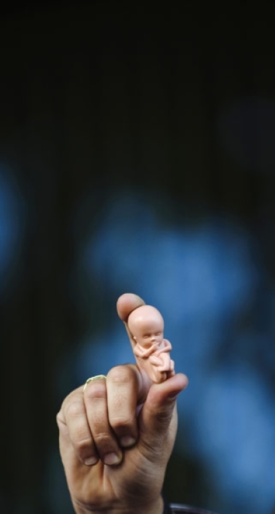 Abortion