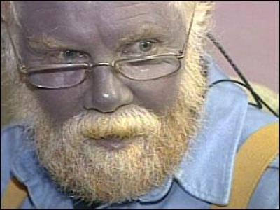 Paul Karason Real Life Blue Man Dies At 62 Photo The Christian Post