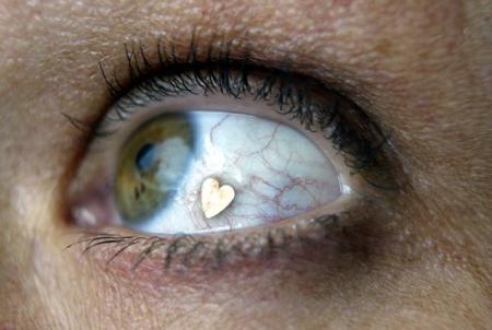 Deborah Boer models the "Jewel Eye" in her hometown of Driebergen, the Netherlands in 2004. The surgical eyeball jewelry implant fad made its way to New York a few weeks ago.