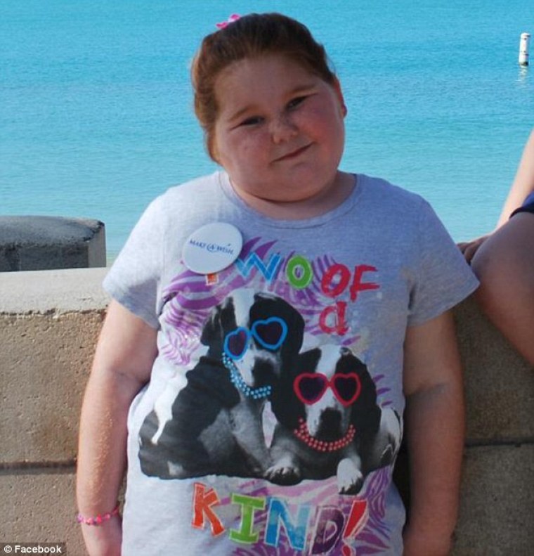 12-year-old-to-receive-life-saving-gastric-bypass-surgery-after-gaining