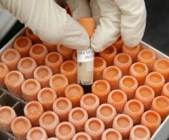 Japanese Researchers Create Stem Cells Through Acid Bath