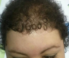 Cancer Survivor Believes God Answered Her Prayer for Strength With an Old Facebook Photo