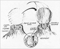 Chinese Doctor Preparing for First Human Head Transplant Is 'Unethical,' Says CMDA President