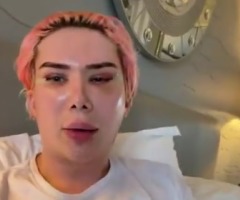 UK ‘nonbinary’ man undergoes 18 ‘transracial’ cosmetic surgeries to look like Korean pop star