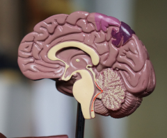 Elon Musk's brain chip startup gets FDA approval to start human trials; patient registry open