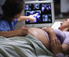 'Dedicated to the Lord': ERLC's Psalm 139 Project gifts 100th ultrasound machine to pro-life resource centers