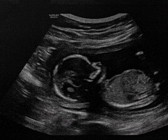 What kind of civilized nation allows babies to be dismembered?