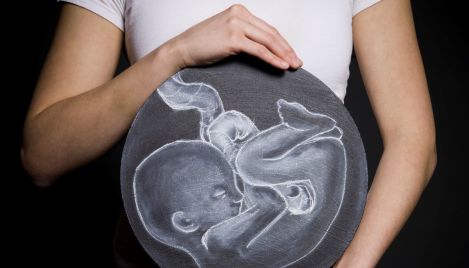 My parents adopted 20 embryos. I was the only one to survive.