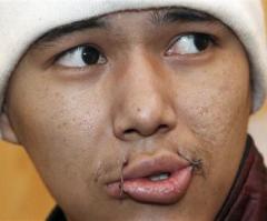 Kyrgyzstan Prisoners Sew Mouths Shut in Protest