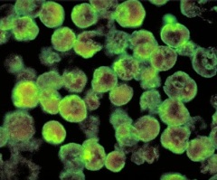 Brain-eating Amoeba Kills 10 in Pakistan: Where is it Found?