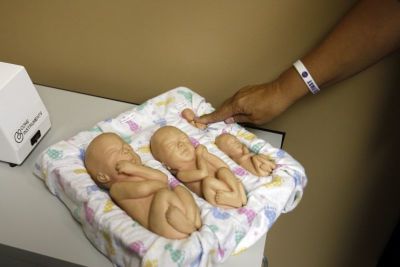 Executive Director of Alternatives Pregnancy Center Janet Lyons points to a plastic replica of a fetus at 12 weeks which is used to show women who come into the center to find out if they are pregnant and what the stage of growth looks like, in Waterloo, Iowa, July 6, 2011.