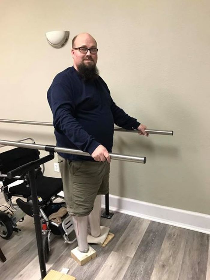 Jason Weaver stands up in his check sockets during a doctor visit, February 2017.