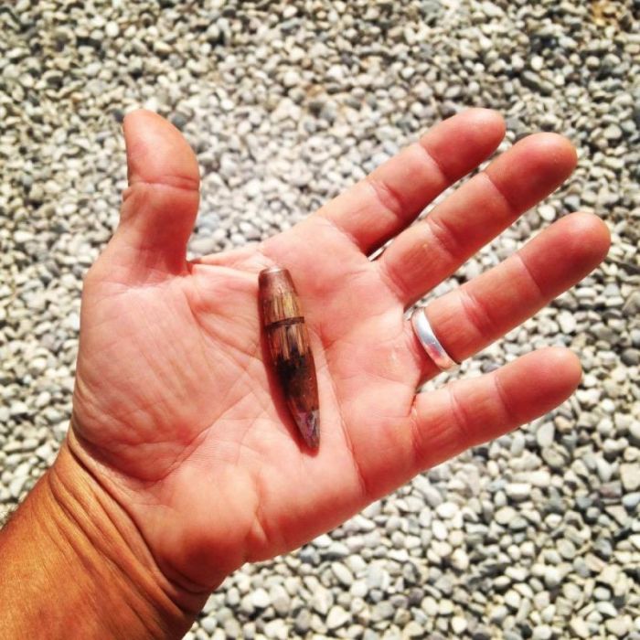 A Samaritan's Purse medical professional holds a 50-caliber bullet that was pulled out of the body of a pre-teen boy shot by ISIS in this photograph shared by Franklin Graham on March 13, 2017.