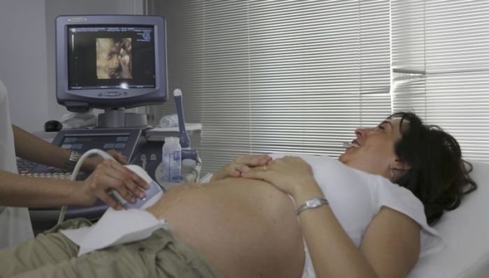 A pregnant woman is seen getting an ultrasound scan.