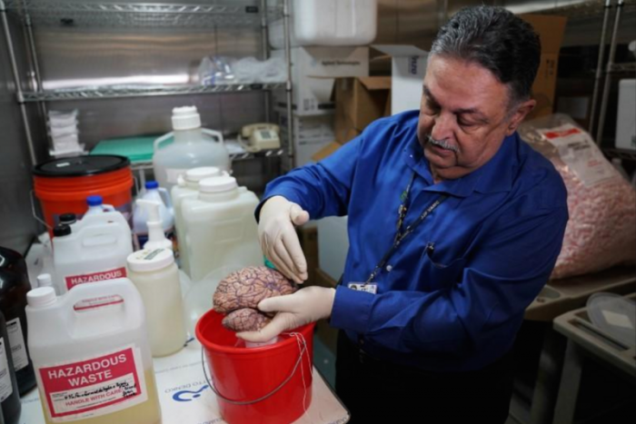 Dr. Vahram Haroutunian holds a human brain in a brain bank in the Bronx borough of New York City, New York, U.S. June 28, 2017. Picture taken June 28, 2017.