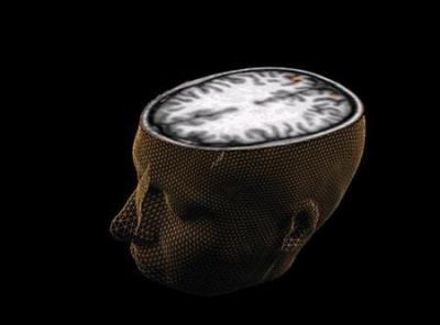 An undated image of the human brain taken through scanning technology.