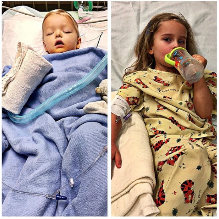 Jaxson and Addie Taylor now hospitalized with E. coli, Jan 2018.