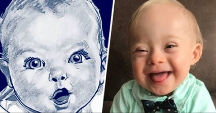 Lucas Warren, the first Gerber baby with Down syndrome, February 7, 2018.