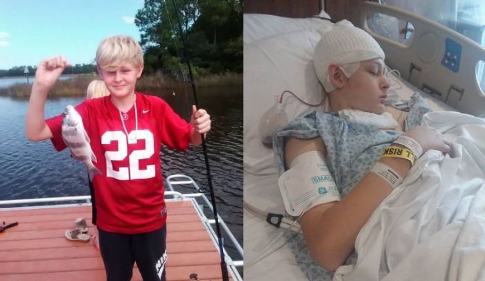 Trenton McKinley, 13, before and after the accident that temporarily left him brain dead.