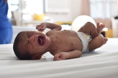 At 1 month old and only four pounds heavy, Hilda was severely malnourished.