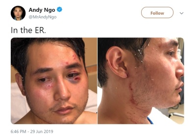 Quillette editor Andy Ngo posted photos of himself at a hospital following an attack on him by Antifa at a protest in Portland, Oregon on Saturday, June 29, 2019. 