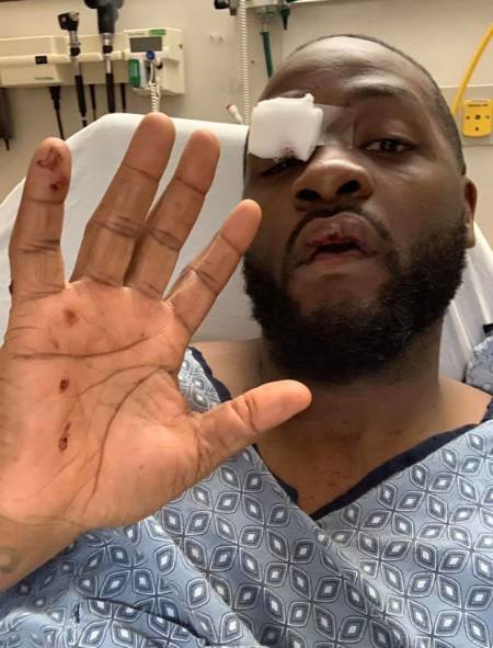 Demarco “Gemstones” Castle at a hospital after surviving an ambush in 2019.