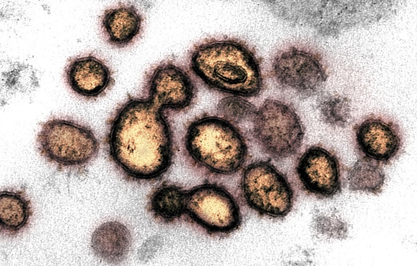 This transmission electron microscope image shows SARS-CoV-2, the virus that causes COVID-19, isolated from a patient in the U.S. Virus particles are shown emerging from the surface of cells cultured in the lab. The spikes on the outer edge of the virus particles give coronaviruses their name, crown-like.