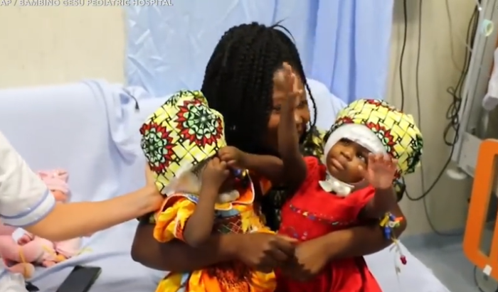 Separated, formerly conjoined twin girls from Central African Republic at Gesu Bambino hospital in Rome. 