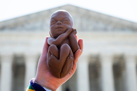 Supreme Court rejects Biden admin. push to force Texas ER doctors to perform abortions