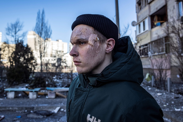 An injured resident stands by a residential building that was hit by the debris from a downed rocket in Kyiv on March 17, 2022. - One person was killed and three injured when debris from a downed rocket hit a Kyiv apartment block, as Russian forces press in on the capital, emergency services said. Russian troops trying to encircle Kyiv have launched early morning strikes on the city for several successive days, putting traumatized residents further on edge. 