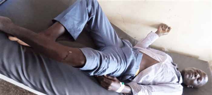 Emmanuel Mugabi after the assault in Bukomero, Uganda