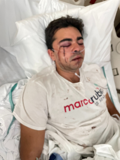 A Republican canvasser identified as Christopher Monzon lays in a hospital bed after he was attacked while handing out fliers on behalf of the Republican ticket in Hialeah, Florida, on Oct. 23. 