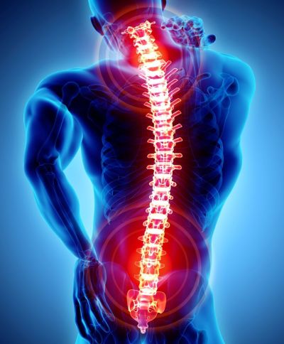 xray, backbone, spine
