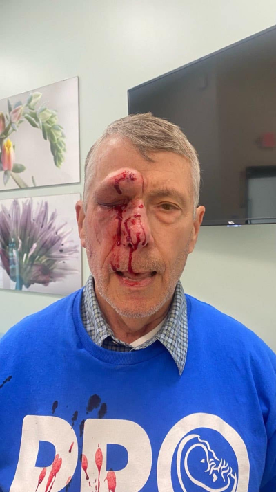 Pro-life activist Mark Crosby was assaulted outside a Planned Parenthood in Baltimore, Maryland, May 26, 2023.