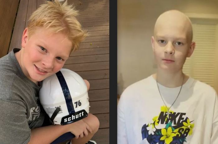A composite of undated photos of Pike Petersen before and after undergoing chemotherapy.