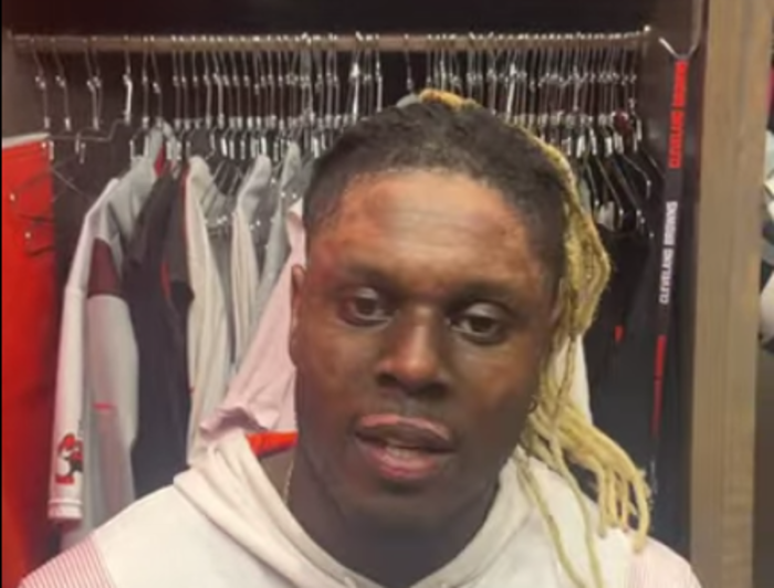 Cleveland Browns football player David Njoku talks to reporters about why he elected to post a picture of the burns he sustained on his face. 