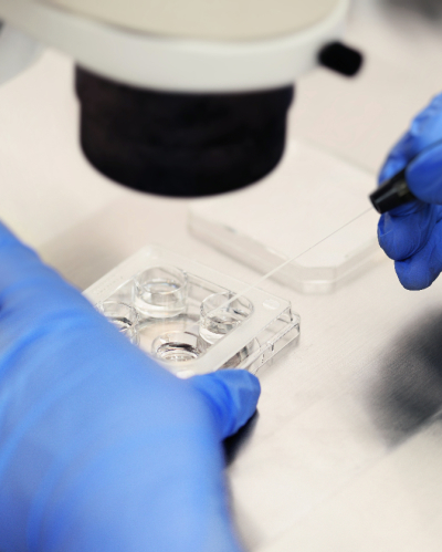 A process of artificial insemination of an egg in an IVF clinic. 