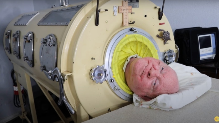Paul Alexander, above, spent 72 years largely confined to an iron lung that allowed him breathe after polio paralyzed his chest muscles when he was 6 years old.