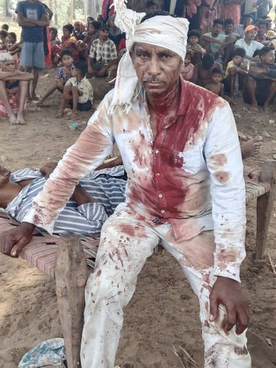 Sukra Madi was beaten for his faith on June 21, 2025, in Kotamateru village, Malkangiri District, Odisha state, India. 