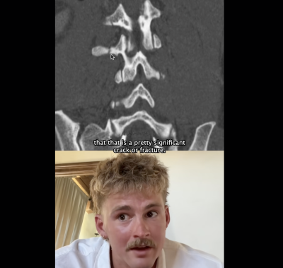 Forrest Frank TikTok/Screenshot